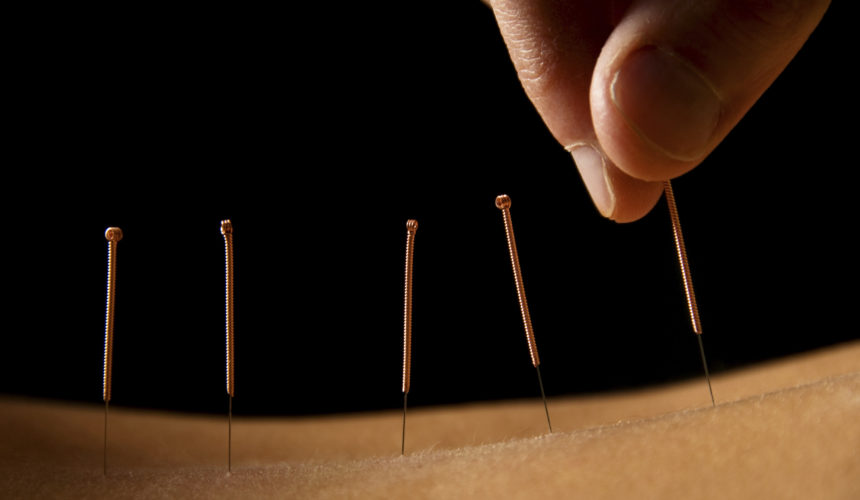 Online-Ausbildung Akupunktur
