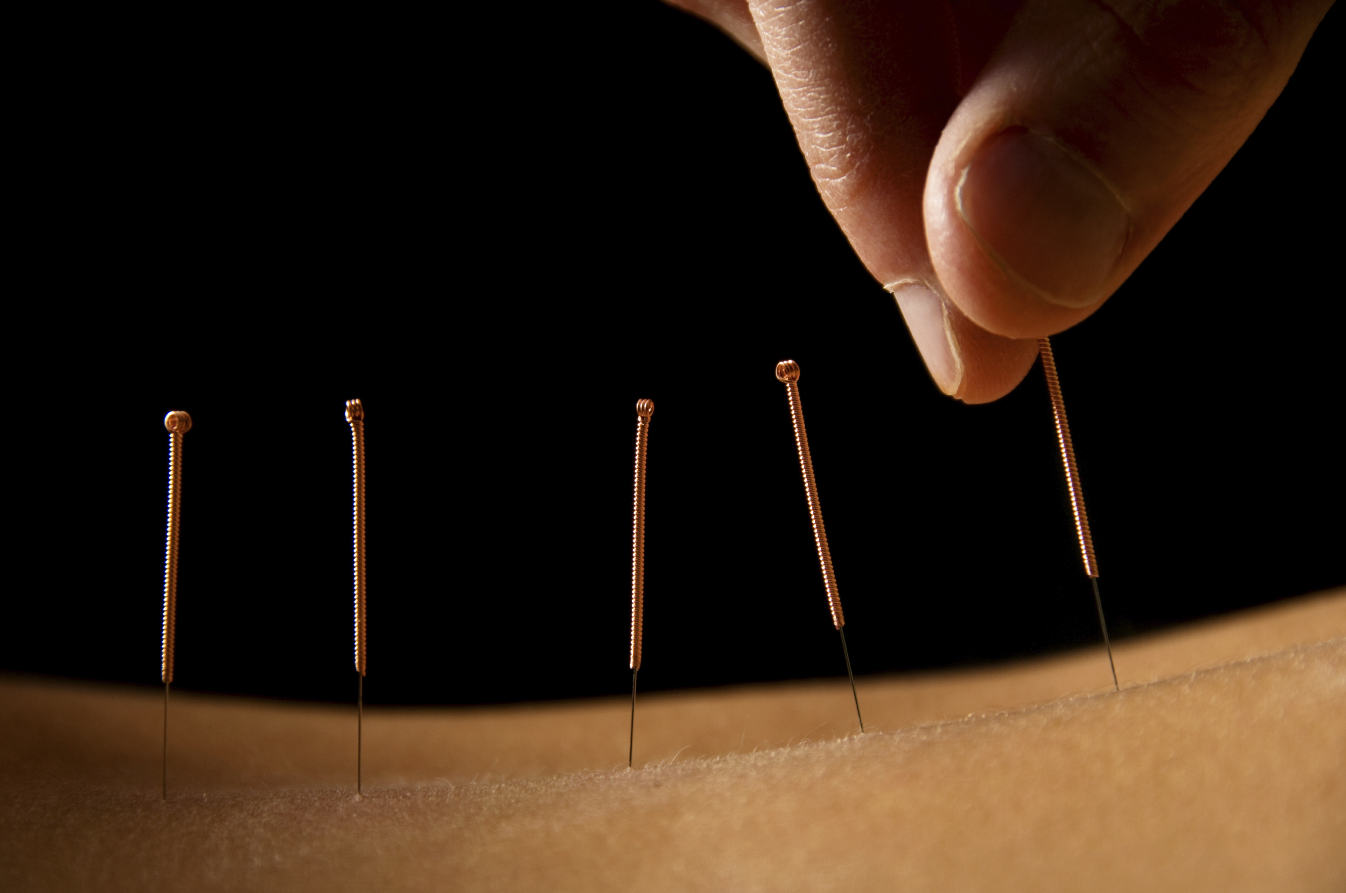 Online-Ausbildung Akupunktur