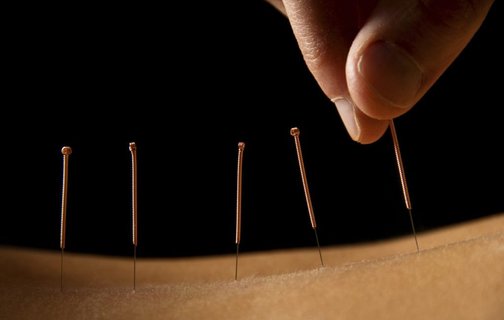 Akupunktur Starterkurs