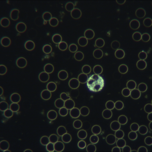 Bild von Dunkelfeld-Mikroskopie