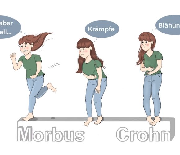 Morbus Crohn oder wie ich es liebevoll nenne „Cröhnchen“ – Teil 2: Symptome