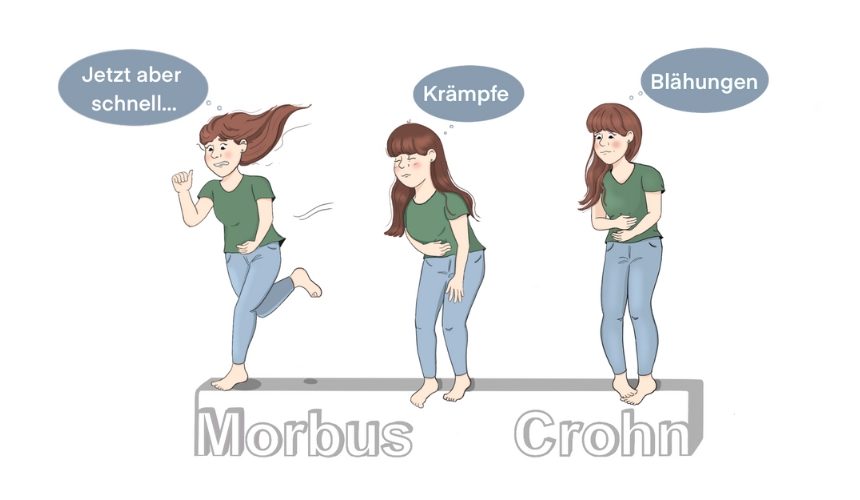 Morbus Crohn oder wie ich es liebevoll nenne „Cröhnchen“ – Teil 2: Symptome