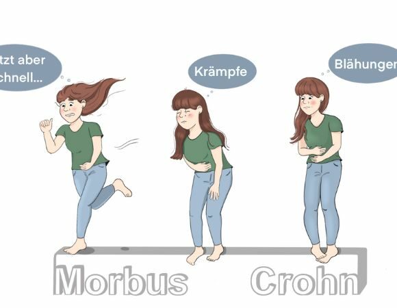 Morbus Crohn oder wie ich es liebevoll nenne „Cröhnchen“ – Teil 2: Symptome