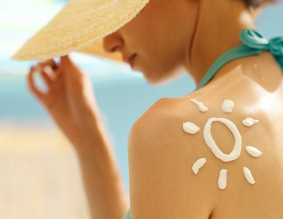 Sonnenbrand – natürliche Hilfe und Prophylaxe